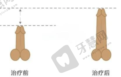 北京丽星翼美医院正规性与整体情况