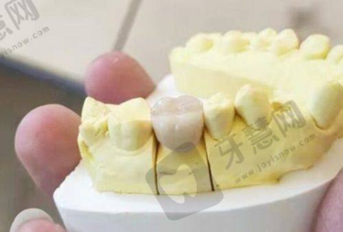 重庆雅博尔口腔门诊部刘渝医生口碑评价
