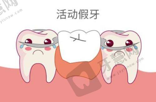 绥化智齿拔牙哪家医院好——绥化市第三医院口腔科