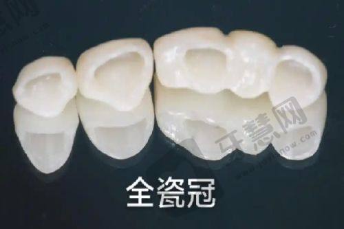 唯美口腔医院:美学与功能兼顾的绥化老人种植牙医院