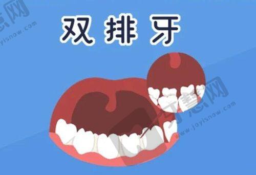 绥化市第二医院口腔科:适合复杂口腔问题老人的种植牙科室