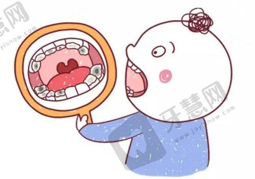 医生口碑评价:重庆牙卫士宋金平医生的患者反馈