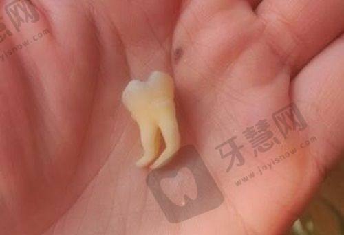 西双版纳牙科种植牙哪家医院好——西双版纳竹子口腔介绍