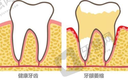 重庆牙卫士口腔凌绍祥医生怎么样？擅长多项目且价格透明，坐诊该专科医院