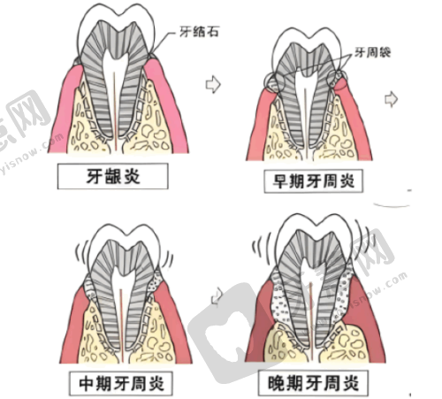总结:选择适合的西双版纳镶牙补牙医院