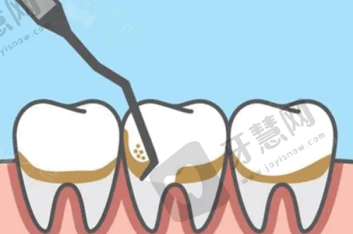 总结呼吁：选择阳光树口腔，重拾健康美丽笑容