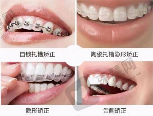 便捷预约重庆怡华金开口腔医院梁圻医生