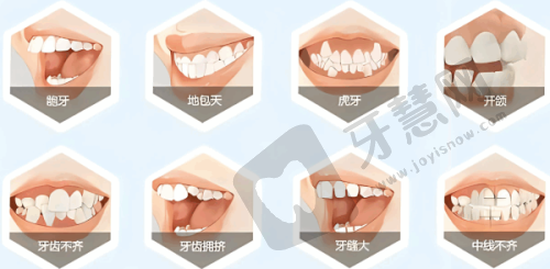 景洪市第一人民医院口腔科——技术雄厚的老人种植牙医院