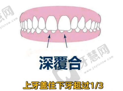 绥化修复牙齿哪家医院好——国有医院口腔科介绍