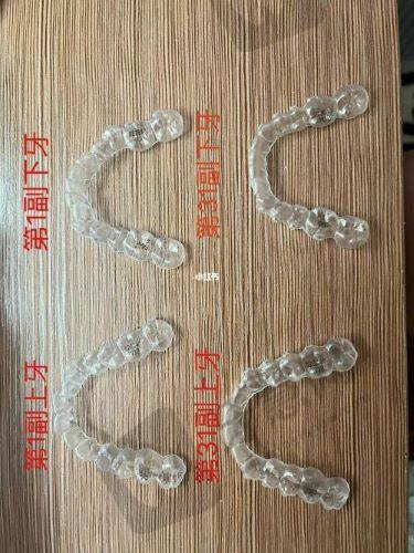 重庆怡华金开口腔医院梁圻医生怎么样？正畸8000起、种植5000起坐诊信息全揭秘