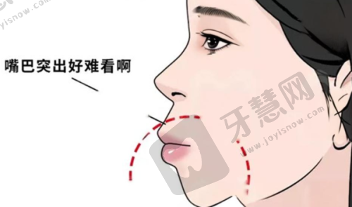 西双版纳智齿拔牙哪家医院好——总结