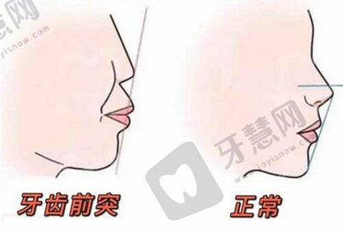福州维乐口腔（马尾君竹路店）真实患者口碑评价