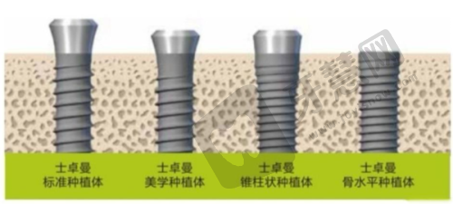 绥化市鑫鹏口腔医院:多样化选择的绥化老人种植牙医院