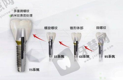 绥化修复牙齿哪家医院好？绥化仪美口腔与绥化市第一医院口腔科，附医生介绍！