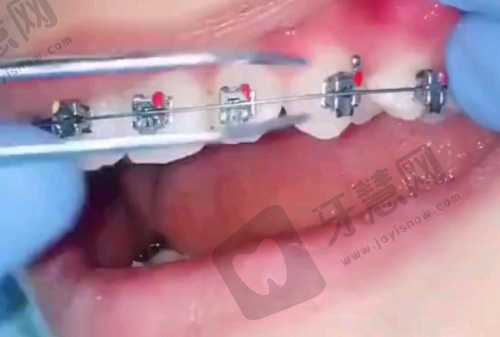 西双版纳补虫牙哪家医院好——总结