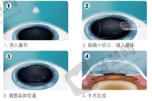 重庆南坪爱尔眼科医院地址、电话、营业时间及预约方式大揭秘