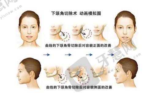 鹏程医美实力沉淀