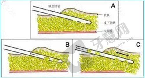 北京煤医西坝河医疗美容地址及挂号方式