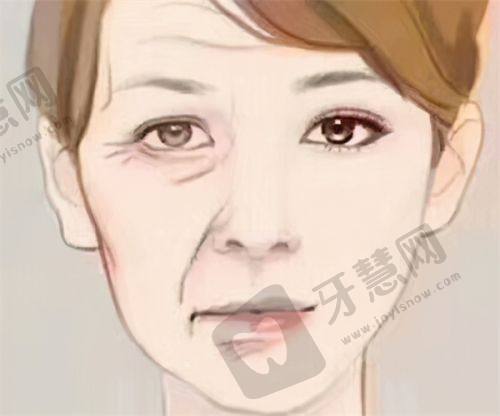 总结