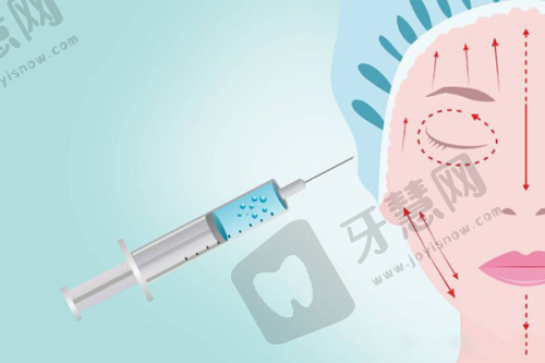 深圳鹏程整形医院价格说明
