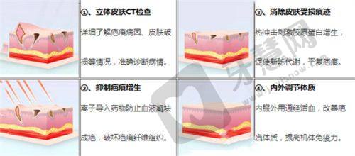 北京张笑天改脸型医院特色