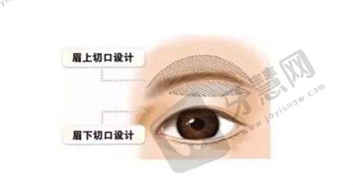 北京叶子整形医院口碑