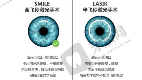 亳州爱尔眼科医院口碑