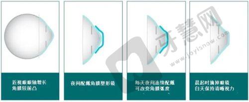 佛山高明爱尔眼科医院实力评估