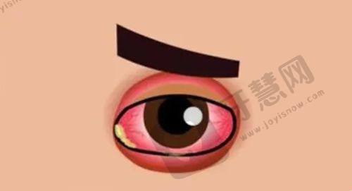 佛山高明爱尔眼科医院简介