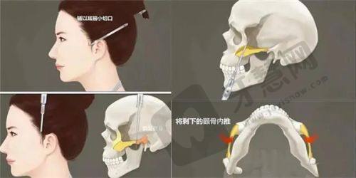 北京丽星翼美医院特色