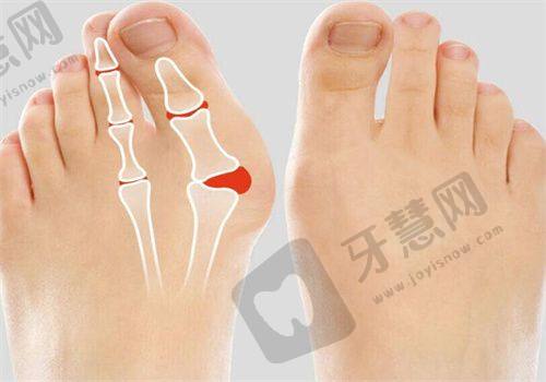 山东滨州方超医学美容——有实力的滨州整形医院