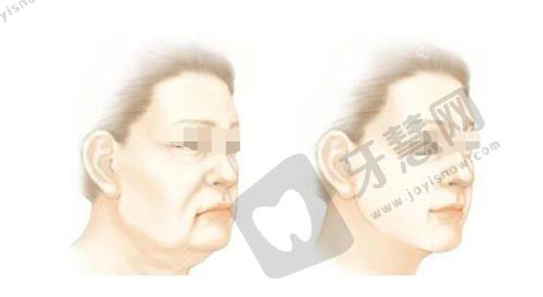 临沂市人民医院——2025临沂整形三等甲医院出色之选