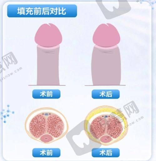 多维度分析广州医 科 大学一附院私密整形