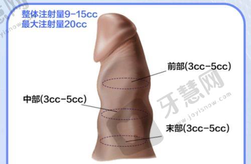 北京禾美嘉吸脂靠谱吗？价格亲民技术优，术后效果有保障