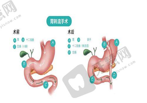 深圳非凡医美20多年口碑佳，医生实力强，吸脂案例效果惊艳