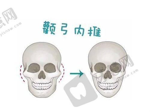 判断误打生长因子的方法及预防措施