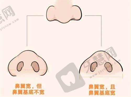 福州雍禾植发门诊部——以患者为中 心的舒适植发体验