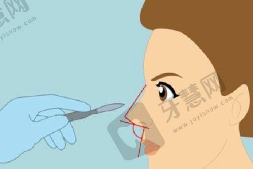 结尾——谨慎选择滨州整形医院实现美丽梦想