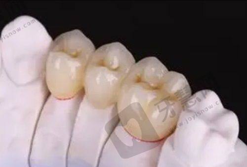 成爱金冠(北京)口腔门诊部正规吗?医院综合评价