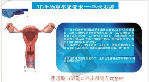 卢元刚医生预约挂号指南详情