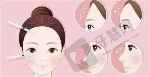 总结:王杨医生——眼袋修复和卧蚕手术的靠谱之选