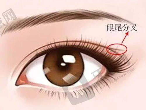 赵善军:成都经验多的鼻子整形品质之选