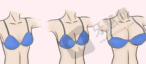 淄博美联臣整形美容医院——淄博个性化设计的正规整形医院