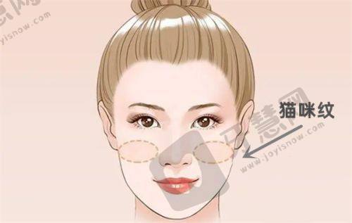 结尾