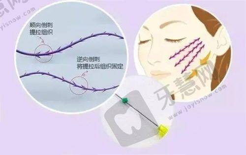 总结结论：实力见证，北京禾美嘉吸脂值得信赖