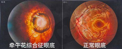 南昌大学第二附属医院眼科术前术后注意事项