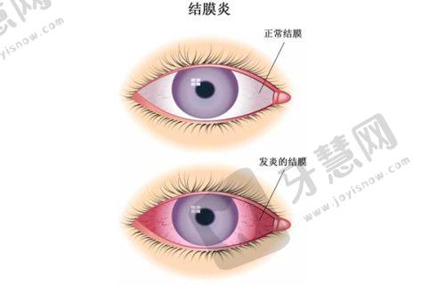 揭秘牡丹江爱尔眼科：资质、专家、技术、价格等全方位大起底