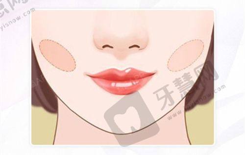 排名4:昆明梦想整形医院——昆明祛疤不错之选