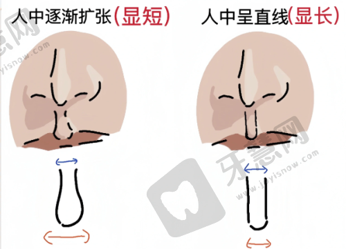 从简介、年龄、口碑看重庆王旭明鼻及鼻修复实力-实力医生可预约