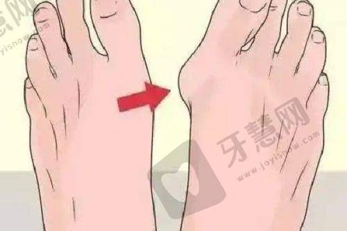 总结